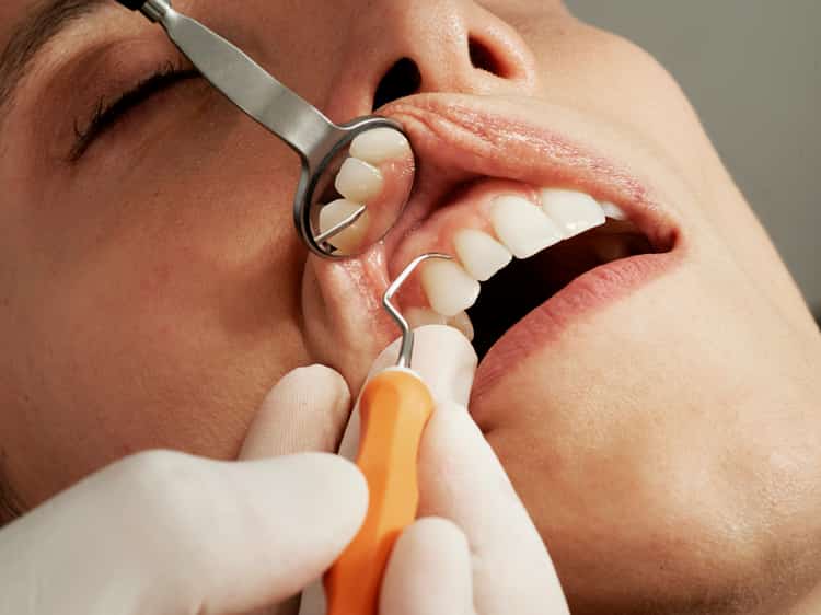 Tratamiento Periodontal