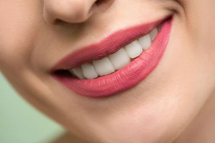 Blanqueamiento Dental Mixto
