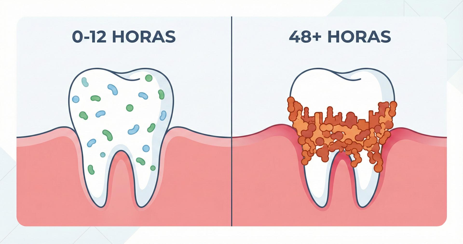 Infografía comparativa de bacterias dentales: dispersas a las 12 horas frente a una biopelícula densa formada a las 48 horas.