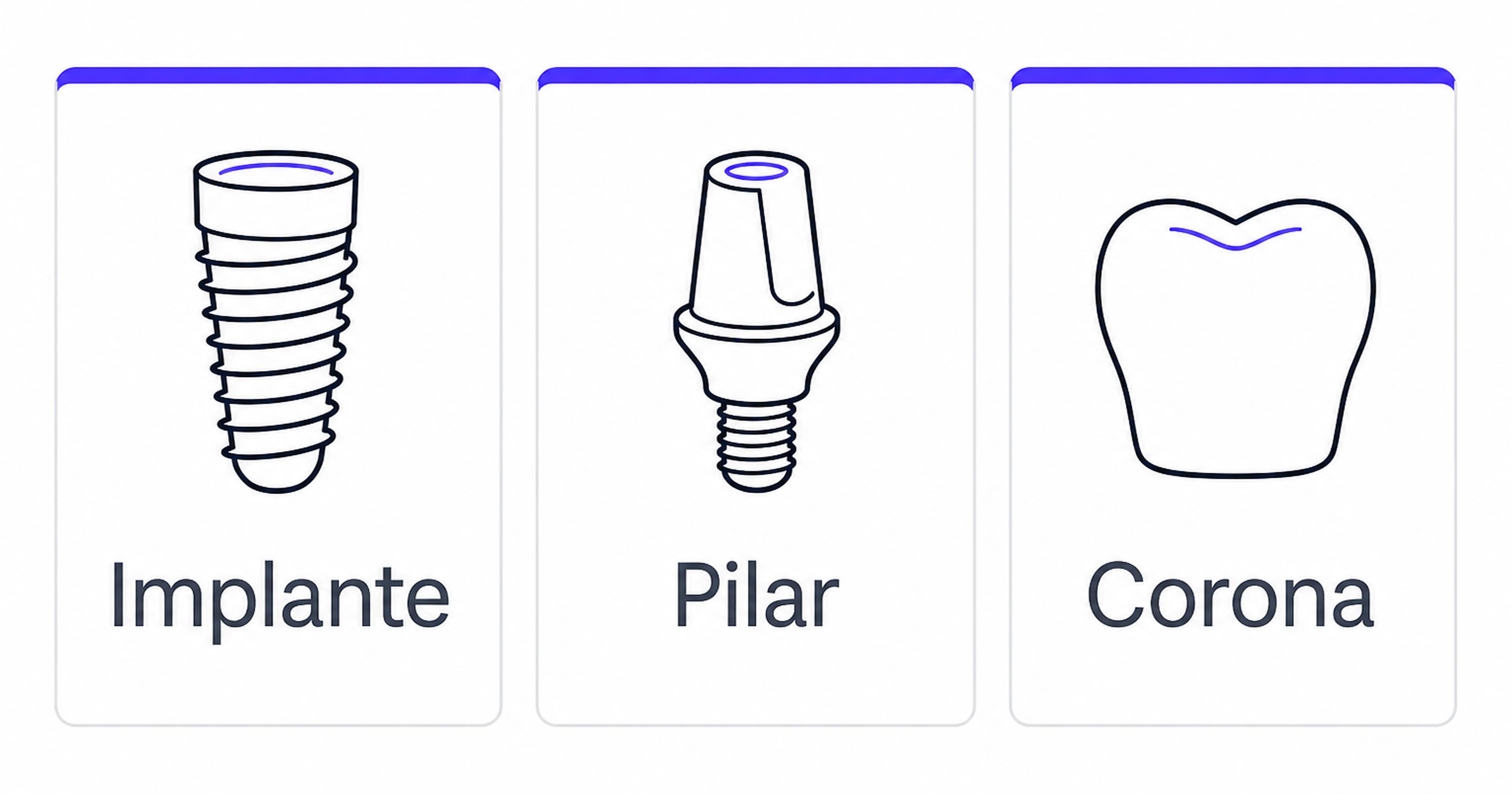 Tres cupones: implante, pilar y corona, con acento índigo.