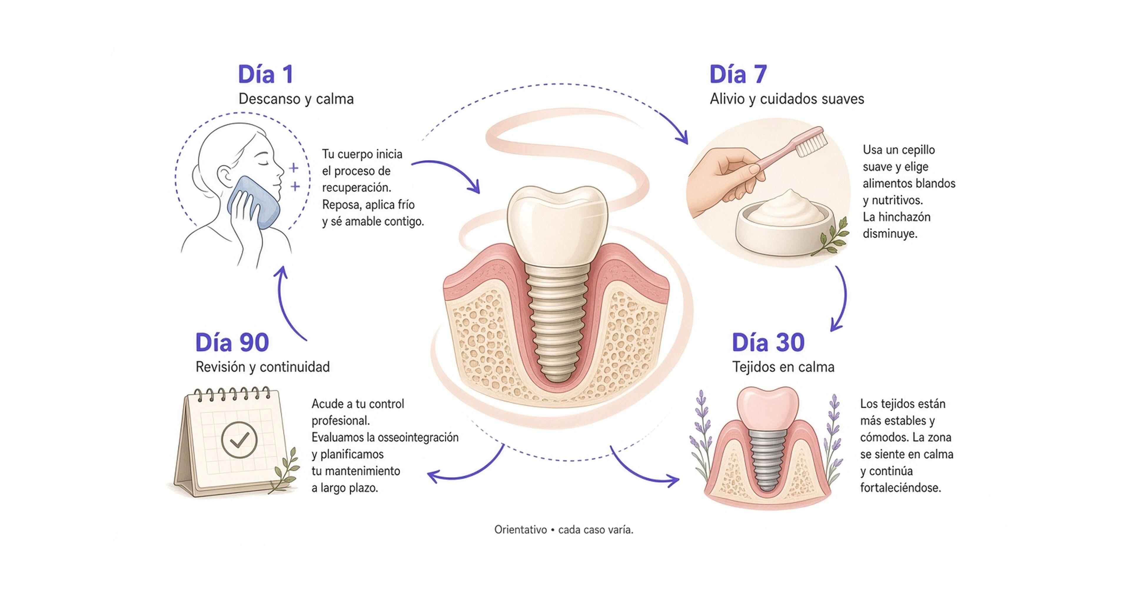 Diagrama circular de recuperación del implante: día 1, 7, 30 y 90 alrededor del implante