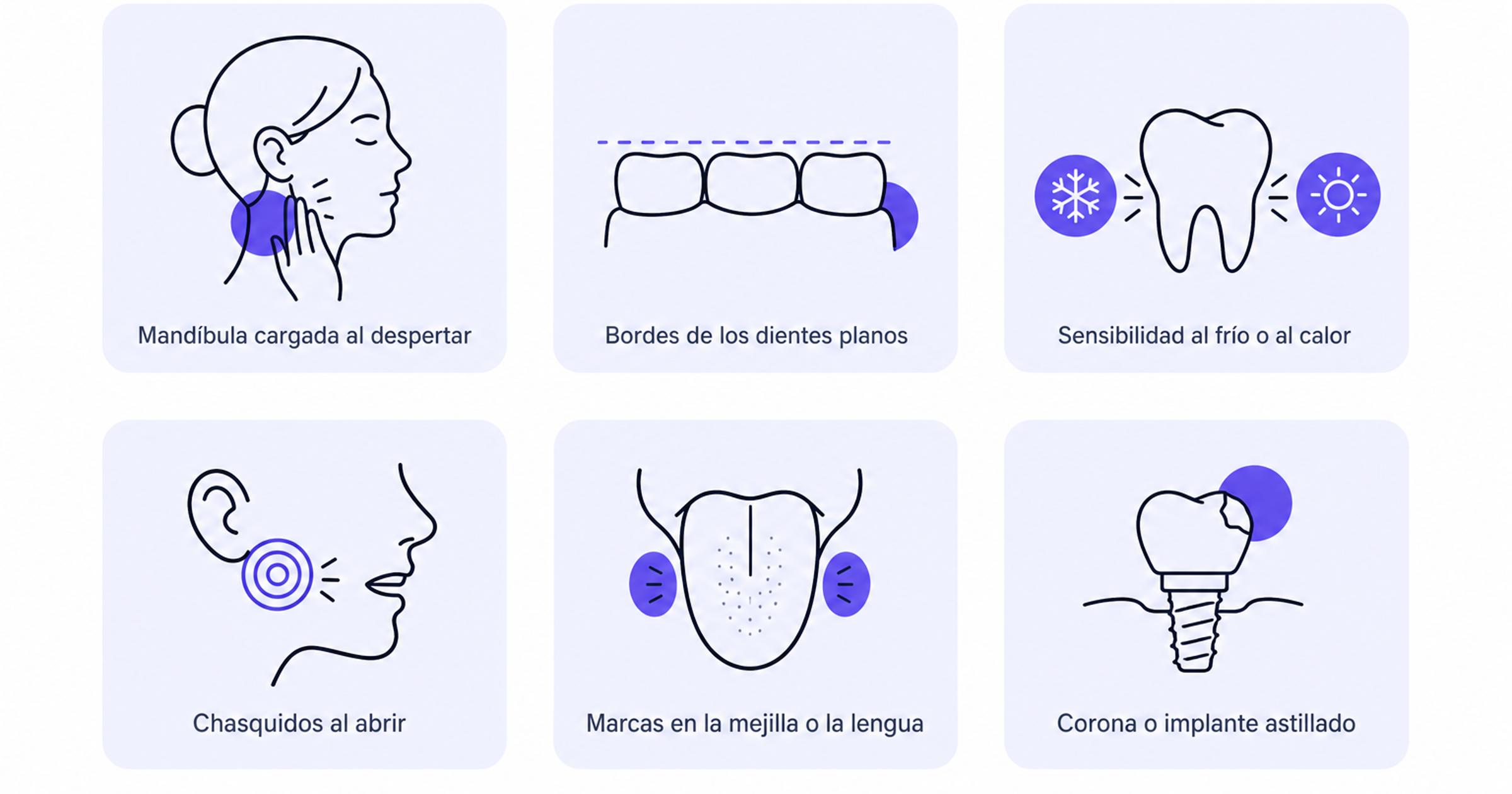 Diagrama con seis señales de apretar o rechinar los dientes: mandíbula cargada, bordes planos, sensibilidad, chasquidos, marcas en la mejilla e implante o corona astillada