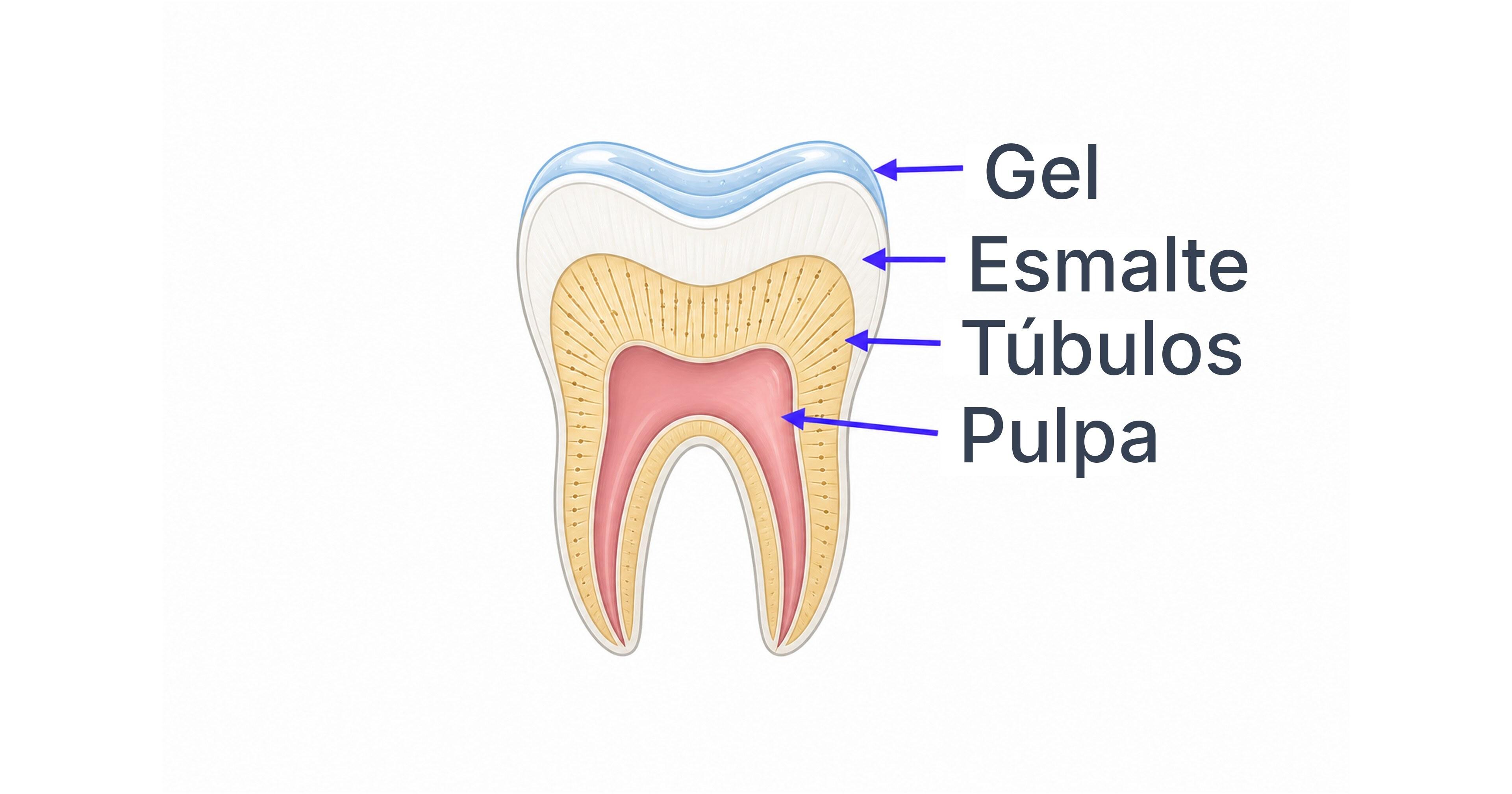 Diagrama del gel blanqueador atravesando esmalte y túbulos dentinarios hasta la pulpa