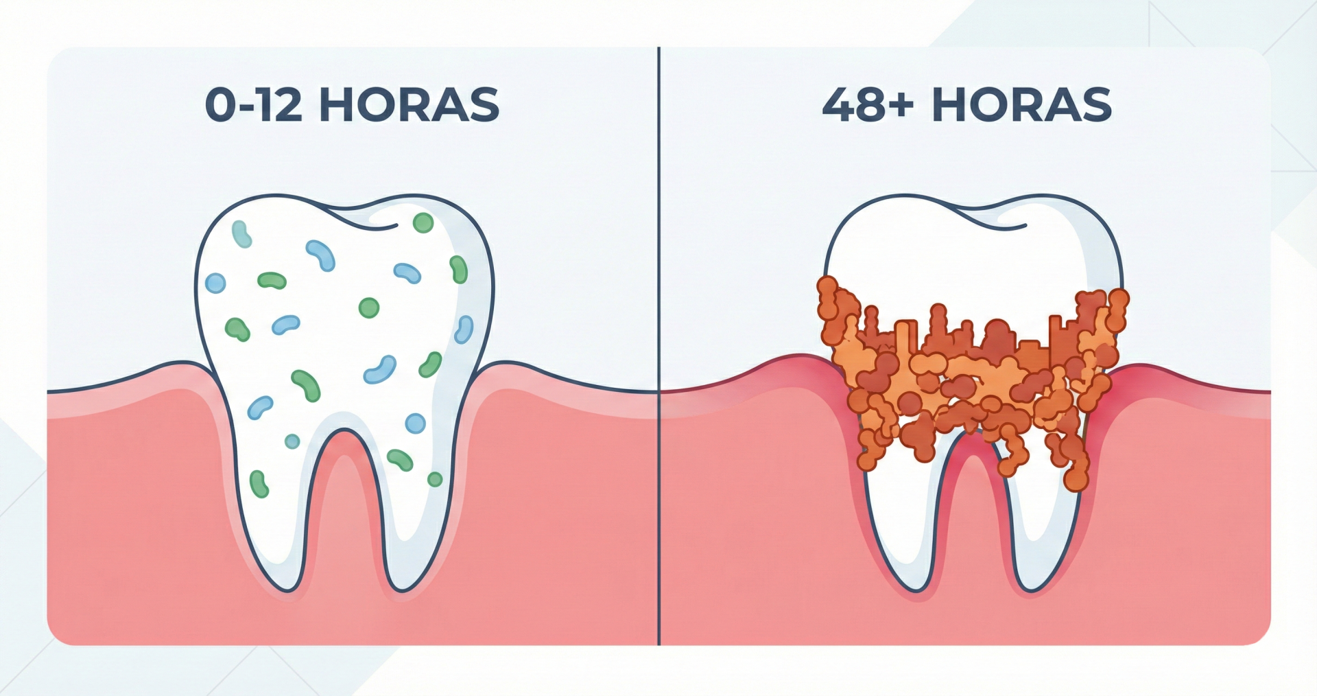 Infografía comparativa de bacterias dentales: dispersas a las 12 horas frente a una biopelícula densa formada a las 48 horas.