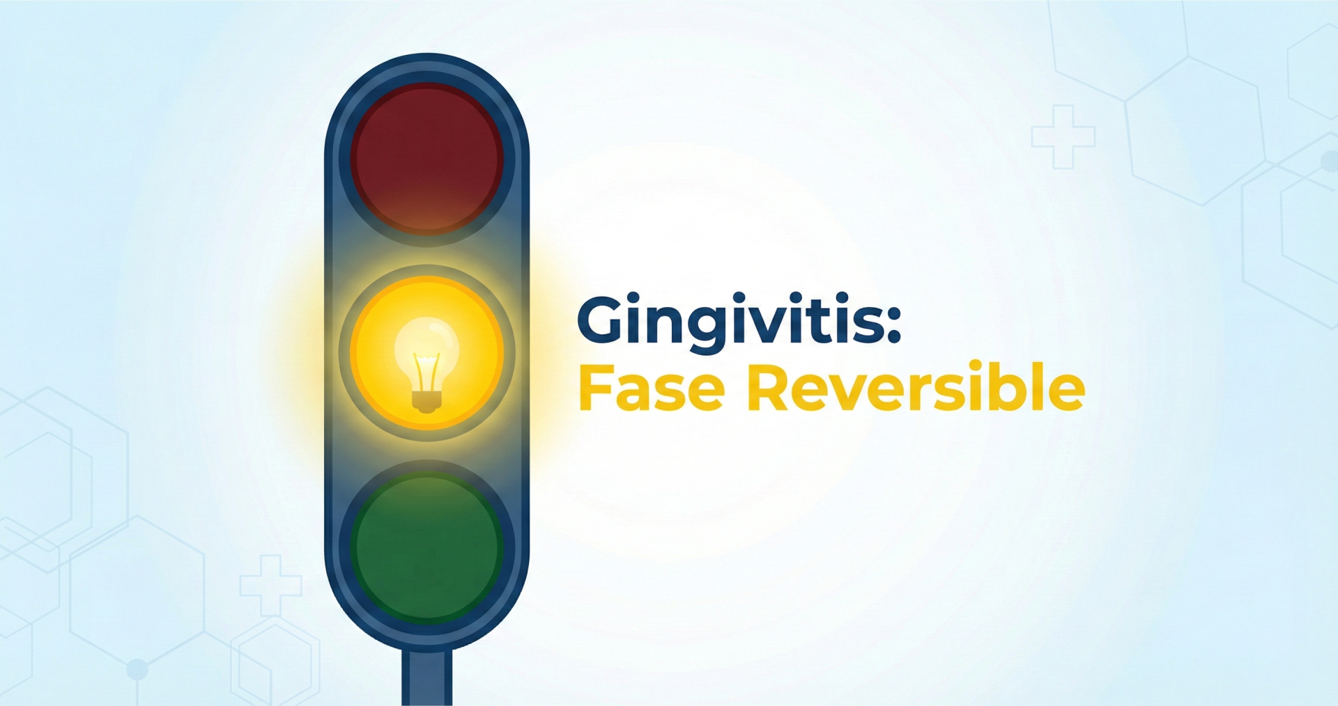 Gráfico de un semáforo con la luz amarilla encendida indicando alerta por Gingivitis en fase reversible.