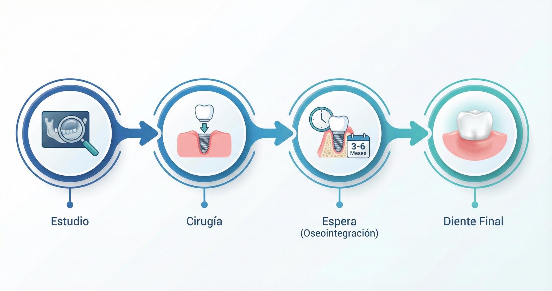 Infografía de las fases del tratamiento de implante dental paso a paso y tiempos de espera.
